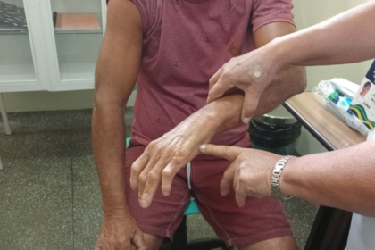 Em seis meses Dermato Saude realizou mais de 13 mil exames dermatologicos no interior do Amazonas 7 Foto Arnoldo Santos Fuham