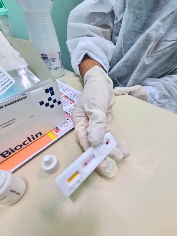 Fundação Alfredo da Matta iniciou a testagem rápida de Hanseníase 2 TESTE RAPIDO DE HANSENIASE NA FUHAM foto arnoldo santos 1