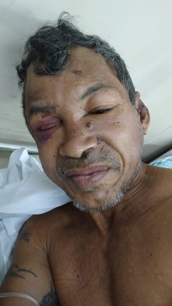 Hospital João Lúcio pede ajuda para encontrar familiares de paciente internado 2 Paciente internado no Hospital Joao Lucio 576x1024 1