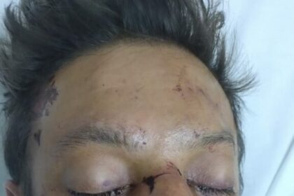 SES AM Joao Lucio pede ajuda para localizar familiares de paciente Foto divulgacao 1 576x1024 1