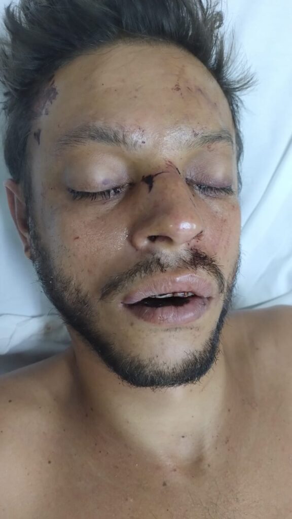 SES-AM pede ajuda para encontrar familiares de paciente internado no HPS João Lúcio 2 SES AM Joao Lucio pede ajuda para localizar familiares de paciente Foto divulgacao 1 576x1024 1