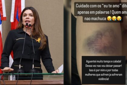 Deputada Alessandra Campelo denuncia lutador de MMA que agrediu ex namorada em Manaus pkEMi3