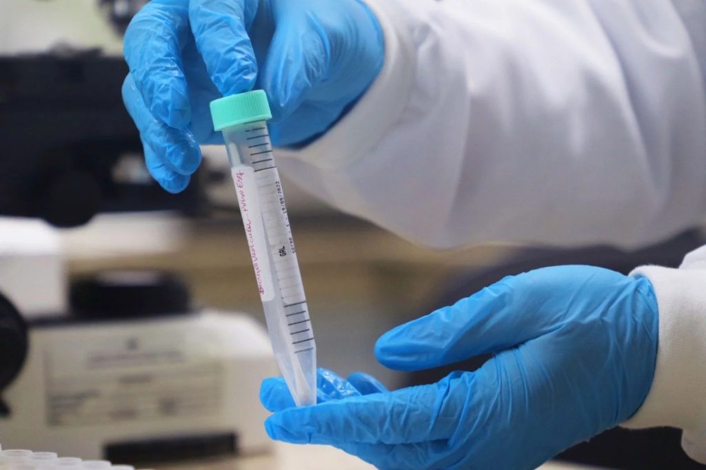 Panorama Epidemiológico da Mpox é atualizado no Amazonas, nesta quarta-feira 2 FVS RCP Informe Mpox FOTO Girlene Medeiros FVS RCP 2 1024x682 1