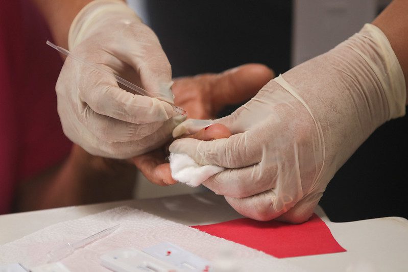 FVS-RCP participa de projeto de identificação de tuberculose e outras doenças na comunidade indígena Parque das Tribos 3 FVS RCP Pesquisa tuberculose Parque das Tribos FOTO Arthur Castro Secom 2 1