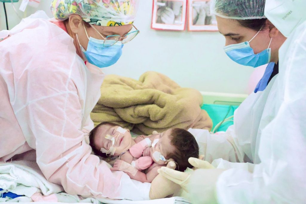 Cirurgia de separação das gêmeas siamesas nascidas no Amazonas é bem-sucedida 7 9a07c879 1c2a 4ef4 99b4 048a30b206a9 1024x682 1