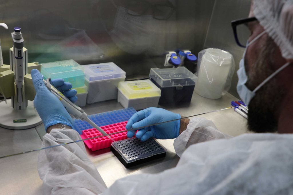 Sem novos casos de Mpox: Amazonas divulga atualização epidemiológica 2 FVS RCP Diagnostico Mpox FOTO Divulgacao FVS RCP V2Vy486 1 1 1024x683 1